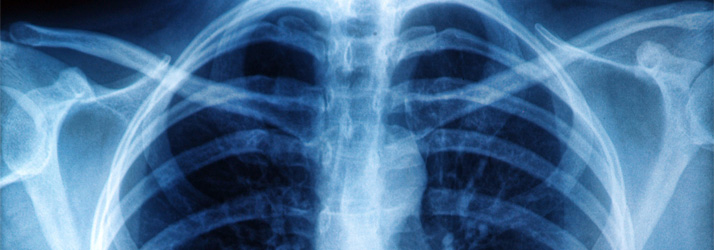 Chiropractic Falls Church VA Digital X-Rays Chiropractic Falls Church VA Digital X-Rays